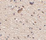 SPRED1 Antibody in Immunohistochemistry (IHC)