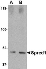 SPRED1 Antibody in Western Blot (WB)