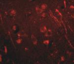 AIPL1 Antibody in Immunohistochemistry (IHC)