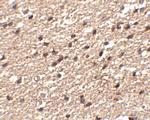 STK39 Antibody in Immunohistochemistry (IHC)