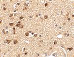 STK39 Antibody in Immunohistochemistry (IHC)