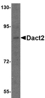 DACT2 Antibody in Western Blot (WB)