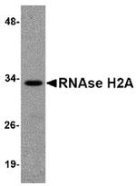 RNAse H2A Antibody in Western Blot (WB)