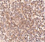 OCC1 Antibody in Immunohistochemistry (IHC)