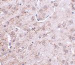 CRMP1 Antibody in Immunohistochemistry (IHC)