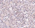 ZIP10 Antibody in Immunohistochemistry (IHC)