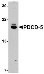 PDCD5 Antibody in Western Blot (WB)