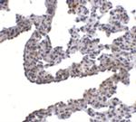 PCDH12 Antibody in Immunohistochemistry (IHC)