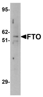 FTO Antibody in Western Blot (WB)