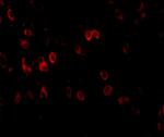 Amyloid Precursor Protein Antibody in Immunohistochemistry (IHC)