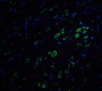 Amyloid Precursor Protein Antibody in Immunohistochemistry (IHC)