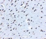 Amyloid Precursor Protein Antibody in Immunohistochemistry (IHC)