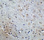 Amyloid Precursor Protein Antibody in Immunohistochemistry (IHC)