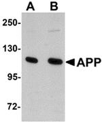 Amyloid Precursor Protein Antibody in Western Blot (WB)