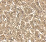 ErbB2 (HER-2) Antibody in Immunohistochemistry (IHC)