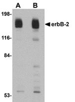 ErbB2 (HER-2) Antibody in Western Blot (WB)