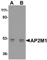 AP2M1 Antibody in Western Blot (WB)