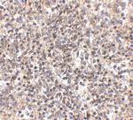 RSPO1 Antibody in Immunohistochemistry (Paraffin) (IHC (P))