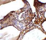 RSPO1 Antibody in Immunohistochemistry (Paraffin) (IHC (P))