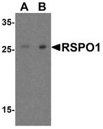 RSPO1 Antibody in Western Blot (WB)