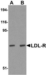 LDLR Antibody in Western Blot (WB)