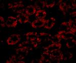 NPC1 Antibody in Immunocytochemistry (ICC/IF)