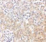 NPC1 Antibody in Immunohistochemistry (IHC)