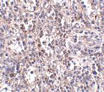 SR-BI Antibody in Immunohistochemistry (IHC)