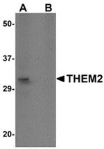 THEM2 Antibody in Western Blot (WB)