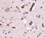 GALNT10 Antibody in Immunohistochemistry (IHC)