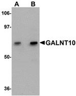 GALNT10 Antibody in Western Blot (WB)