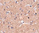 GALNT10 Antibody in Immunohistochemistry (IHC)