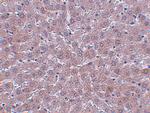 JMJD1B Antibody in Immunohistochemistry (IHC)