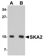 SKA2 Antibody in Western Blot (WB)