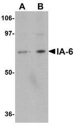 IA-6 Antibody in Western Blot (WB)