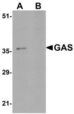 PAGR1 Antibody in Western Blot (WB)