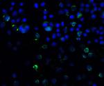 SQSTM1 Antibody in Immunocytochemistry (ICC/IF)