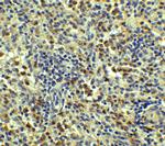 SQSTM1 Antibody in Immunohistochemistry (Paraffin) (IHC (P))