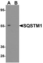 SQSTM1 Antibody in Western Blot (WB)