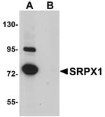 SRPX Antibody in Western Blot (WB)