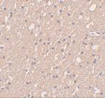 SIPA1L3 Antibody in Immunohistochemistry (IHC)