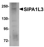 SIPA1L3 Antibody in Western Blot (WB)