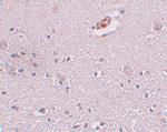 ZNF536 Antibody in Immunohistochemistry (IHC)