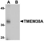 TMEM38A Antibody in Western Blot (WB)