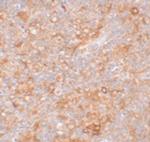 TMEM38B Antibody in Immunohistochemistry (IHC)