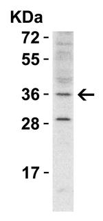 RHBDD1 Antibody in Western Blot (WB)