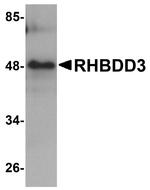 RHBDD3 Antibody in Western Blot (WB)