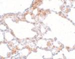 MRE11 Antibody in Immunohistochemistry (IHC)