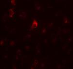 CALM Antibody in Immunohistochemistry (IHC)