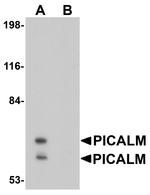 CALM Antibody in Western Blot (WB)